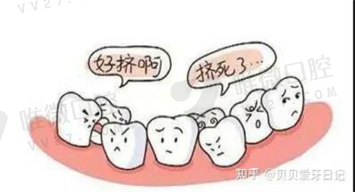 假牙和正常牙有什么区别,种牙和镶牙区别(图1)